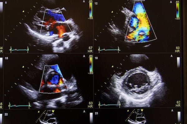 Cardiologo en San Luis Potosi Dr Josue Alejandro Silva Especialista en Ecocardiograma v002 compressor