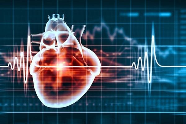 Cardiologo en San Luis Potosi Dr Josue Alejandro Silva Especialista en Taquicardia v001 compressor